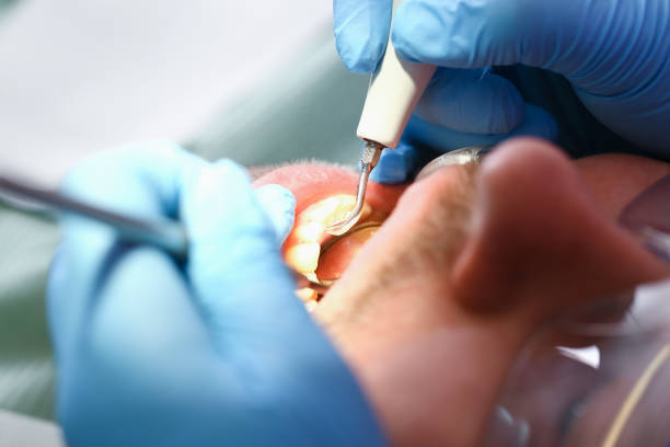 Best Emergency Dental Care for Trauma or Injury in Sonoma, CA