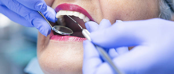 Best After-Hours Emergency Dentist in Sonoma, CA